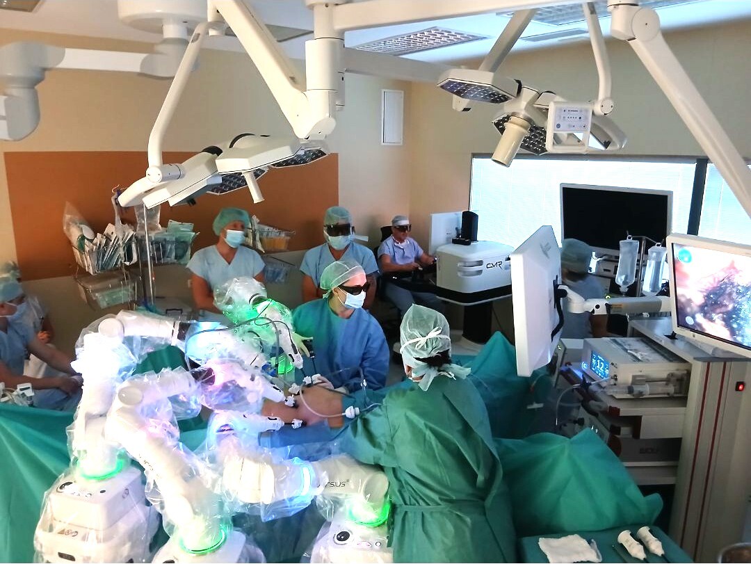 foto operac zakrok s robotickym systemem versius