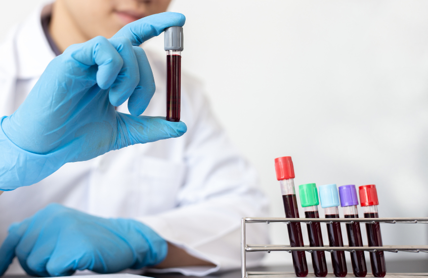 Odběrové pracoviště Klinické laboratoře v Novém Strašecí bude 29. října uzavřeno